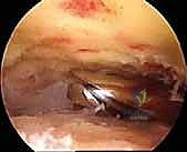 مقارنة بين العلاجات المختلفة لآلام الكاحل