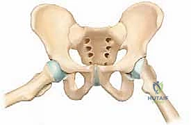 الاحتكاك المفصلي وتدمير الغضروف