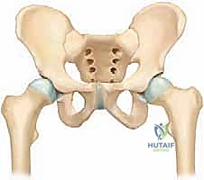 التشخيص الإشعاعي لانزلاق رأس الفخذ المشاشي