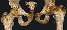 الفحص السريري وتقييم حركة الورك