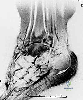 تجهيزات غرفة العمليات الحديثة في صنعاء