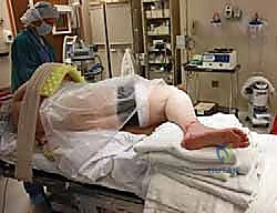 صورة توضيحية لـ تثبيت مفصل الكاحل والقدم الخلفية بالمسمار النخاعي: استعادة الحياة بدون ألم وثبات دائم