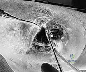 التخطيط الجراحي الدقيق باستخدام الأشعة والتقييم السريري