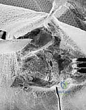 الأشعة السينية النهائية توضح التثبيت الناجح للمفاصل الثلاثة
