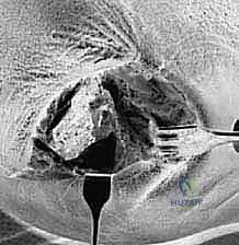 عملية كشط الغضاريف وتحضير أسطح العظام للدمج