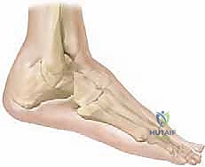 وضع الطعوم العظمية لتحفيز الالتئام بين المفاصل المدمجة