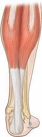 تقييم سريري لدرجة تشوه القدم القفداء