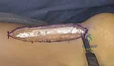 التحضير الدقيق للعملية الجراحية في غرفة العمليات