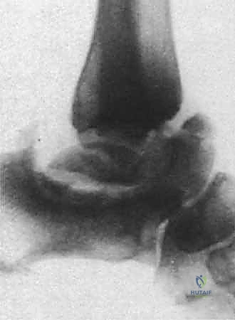 تجهيز المريض في غرفة العمليات