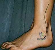 تشريح مفصل الكاحل والكعب وتداخل العظام