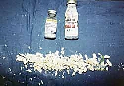 تحديد العلامات التشريحية قبل الشق الجراحي