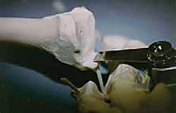 تنظيف المفصل من الأنسجة الميتة