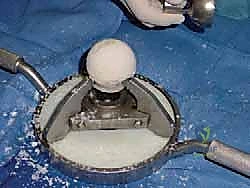 التقييم الإشعاعي والتشخيص الدقيق لحالة الكاحل