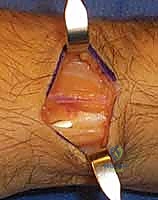 الأستاذ الدكتور محمد هطيف - خبير جراحة العظام في اليمن