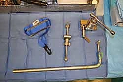 صورة توضيحية لـ منظار الكاحل: دليل شامل للعلاج الدقيق لمفصل القدم مع الأستاذ الدكتور محمد هطيف في صنعاء