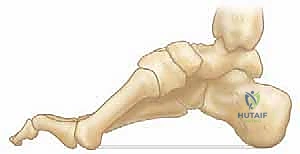 العلاج التحفظي وتقويم العظام