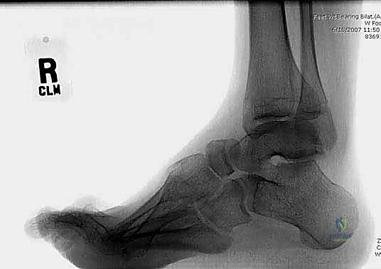 إغلاق الجرح والعناية ما بعد الجراحة