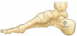 الميكانيكا الحيوية للقدم الجوفاء