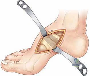 تمارين استعادة النطاق الحركي