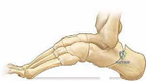 استخدام التقنيات الدقيقة في الجراحة