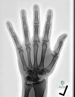 التشخيص الدقيق لآلام الرسغ باستخدام التصوير الطبي المتقدم