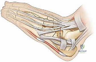 تطور الالتصاق العظمي وتحوله من غضروفي إلى عظمي