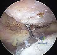 صورة توضيحية لـ الأسباب وعوامل الخطر