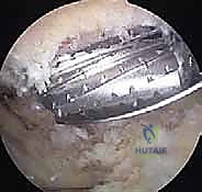 صورة توضيحية لـ التشخيص الدقيق