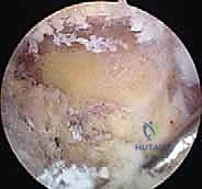 صورة توضيحية لـ الخيارات العلاجية