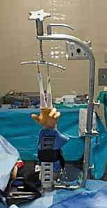 التشريح المعقد لمفصل الرسغ وعظام الكعبرة والزند