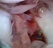 تمارين العلاج الطبيعي لاستعادة المدى الحركي للرسغ