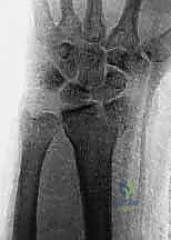 أحدث تقنيات تنظير المفاصل في عيادة الأستاذ الدكتور محمد هطيف