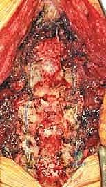 صور أشعة توضح التشخيص الدقيق للمريض