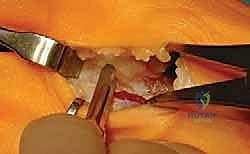 قياسات الأشعة السينية للوكعة