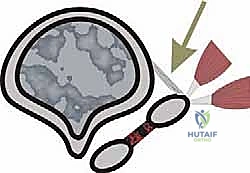 تقييم زوايا التشوه بالأشعة السينية