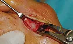 تأثير الميكانيكا الحيوية على القدم