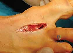 مقارنة قبل وبعد الجراحة