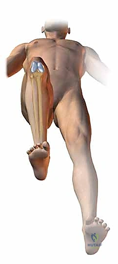 صورة طبية: تثبيت كسر عظم الفخذ بالمسامير الارتدادية: دليل شامل للمرضى في صنعاء مع الأستاذ الدكتور محمد هطيف