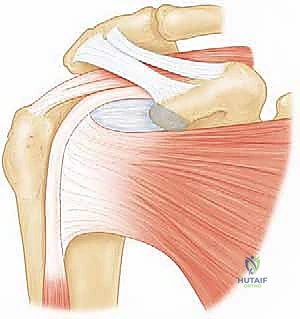 خطوات الجراحة الدقيقة باستخدام المنظار