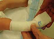 فحص القدم الحنفاء