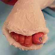 مقارنة العلاجات