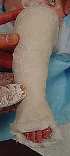 تصحيح الانحراف والانقلاب