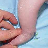 أ.د. محمد هطيف أثناء الفحص