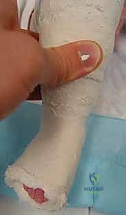 المعالجة اليدوية