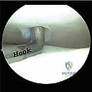 الفحص السريري المتقدم