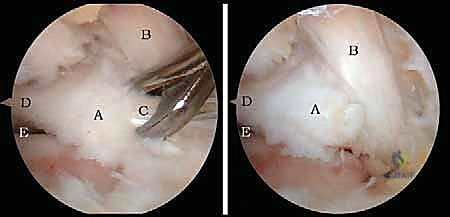 التشخيص بالأشعة السينية