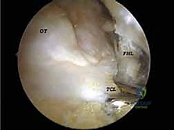 فحص الكاحل السريري