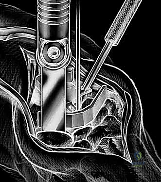 صعوبة حركة الرسغ بسبب الألم