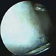 الأستاذ الدكتور محمد هطيف يتابع حالة مريض بعد العملية