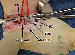 خياطة الجروح الجراحية بتقنيات تجميلية